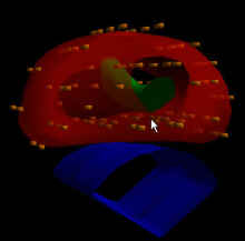 Three-dimensional rendering of seed positions for permanent prostate brachytherapy