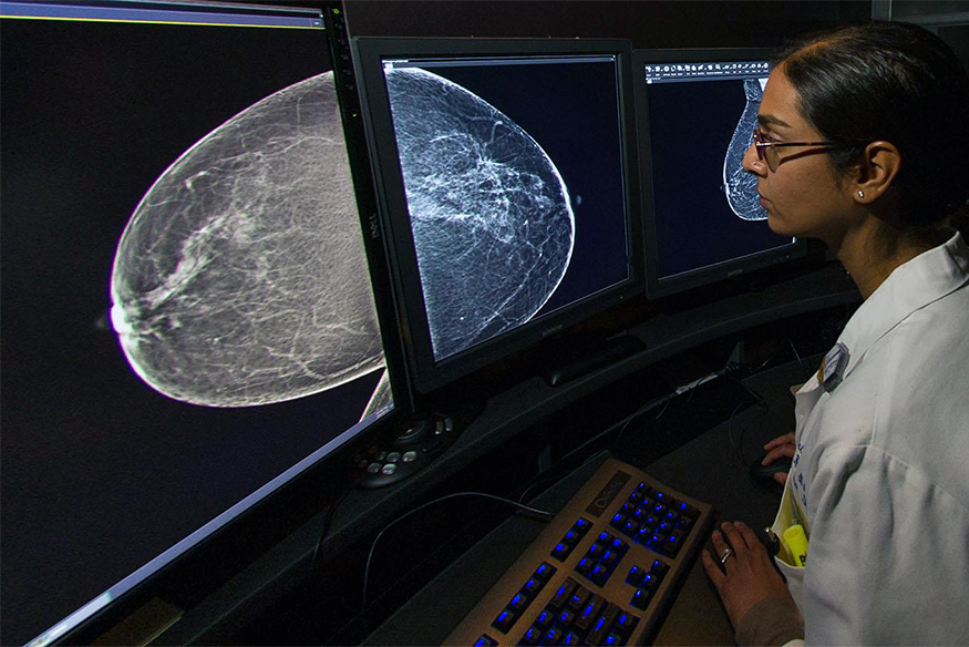 Massey physician reviews breast scans at a computer